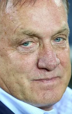 Advocaat'ten takıma neşter