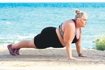 Obezite değil lipödem! Sinsice sağlığınızı hedef alıyor