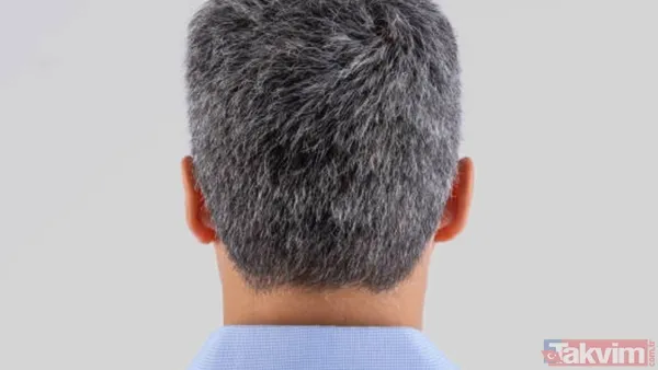 Saçlarınız neden erken beyazlıyor? Genetik mi, stres mi? Cevabı şaşırtacak… - 8