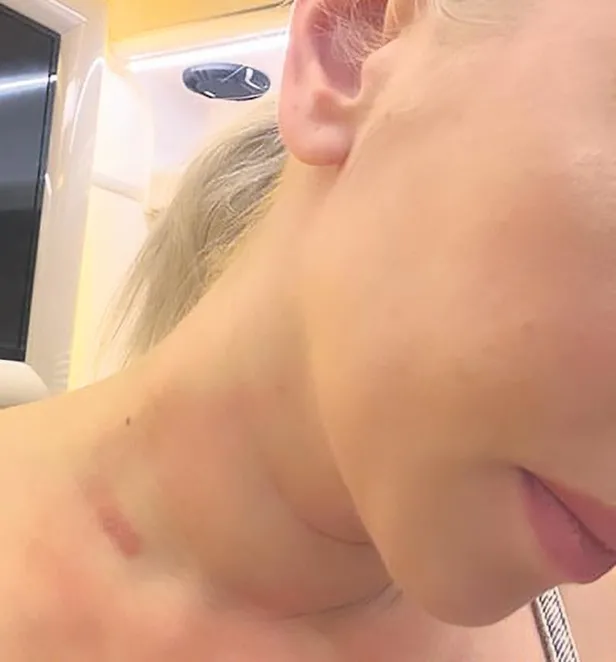 Ece Seçkin sahnede yaralandı! Akımın son kurbanı oldu