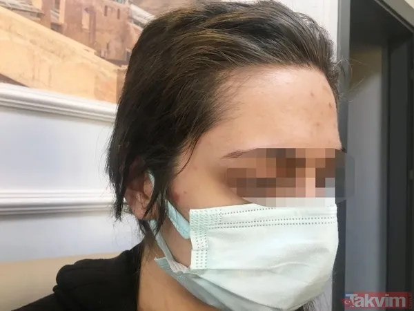 Kadınlardan kadınlara korkunç taciz ve işkence! Mağdur sayısı artıyor! "Yüzümde sigara söndürdüler" - 3