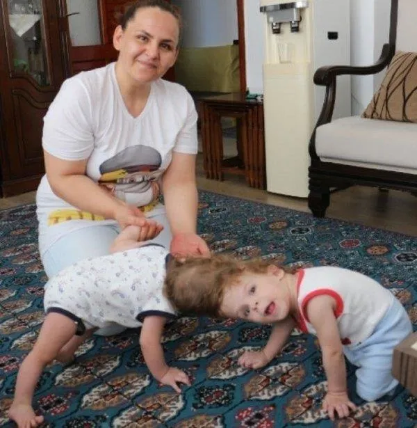 baskan-erdogan-baslari-yapisik-iki-kardesle-ilgili-sevindiren-haberi-verdi-1591648999318.jpeg Başkan Erdoğan başları yapışık iki kardeşle ilgili sevindiren haberi verdi!-2