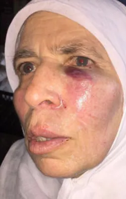 İzmir'de yaşlı kadına ‘evet’ dayağı