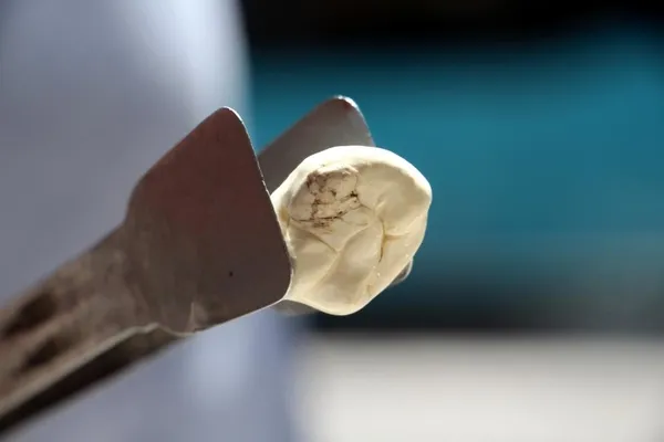 fiyati-altinla-yarisan-kenger-sakizi-bircok-hastaliga-iyi-geliyor-1659435249372.jpg Fiyatı altınla yarışan kenger sakızı birçok hastalığa iyi geliyor-6