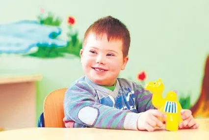 Down sendromlular desteklenecek