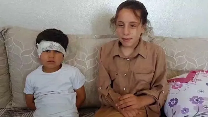 viransehirdeki-kopek-dehsetinde-abla-reyhan-sarik-o-anlari-anlatti-1782738115004.jpeg Viranşehir'deki köpek dehşeti! 8 yaşındaki Abdulkadir'in ablası konuştu: Babam ve amcam kardeşimi kurtardı-4