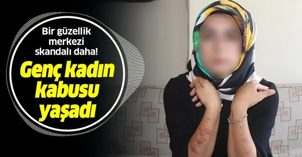 Son Dakika Bir Guzellik Merkezi Skandali Daha Lazer Genc Kadinin Vucudunu Yakti Takvim