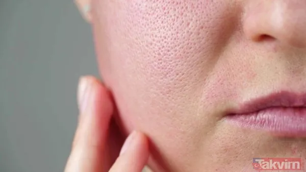 Cildi pürüzsüzleştiren besin! Canan Karatay’ın gözenekleri yok eden şaşırtıcı formülü - 7