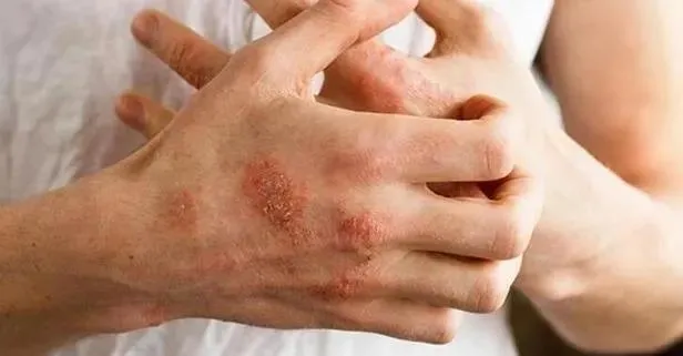 Egzamaya ne iyi gelir?