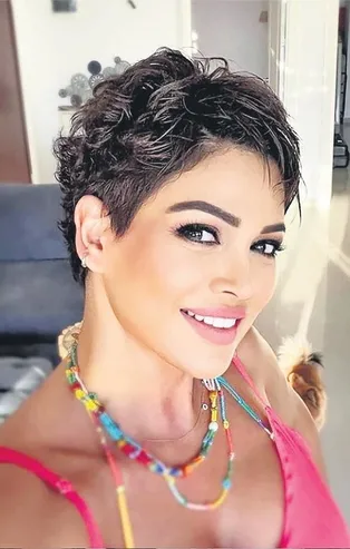 Trafik kazasından sağ kurtulan eski manken Didem Taslan: Yeniden doğdum