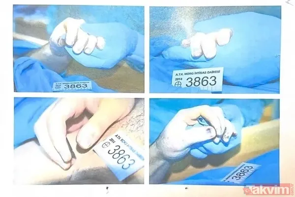 Münevver Karabulut dosyasında yeni gelişme! 10 yıl sonra Cem Garipoğlu'nun otopsi görüntüleri ortaya çıktı! Parmakları neden mordu? Uzman isim yanıtladı - 7