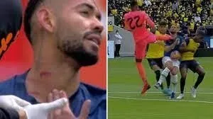 Matheus Cunha ölümden döndü! Dünya Kupası elemelerinde Ekvador ile Brezilya maçında şok olay!-4