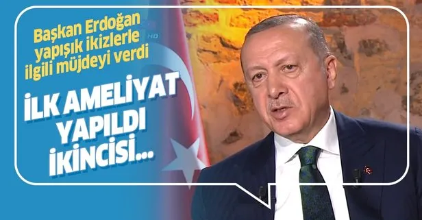 Başkan Erdoğan yapışık ikizlerle ilgili müjdeyi verdi: İlk etabı yapıldı