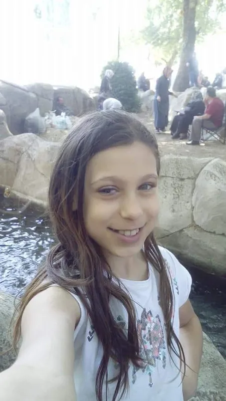 İzmir'de korkunç olay! Gözünü bıçakladı - 3