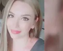 İstanbul’da botoks sonrası ölüm iddiası!