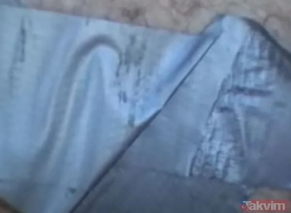 Karnındaki şişlik için gitti içinden çıkan doktorları bile şoke etti! Yer uzak değil Kayseri! 64 kilo girdi 55 kilo çıktı - 17