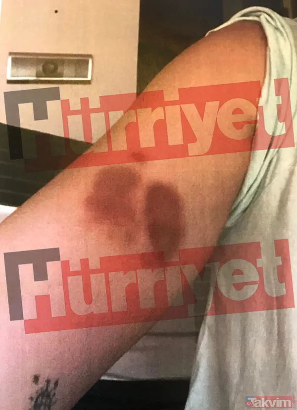 "'Bunları Anlatmaya Ne Gerek Var Deniz. Nasıl Seviştiğinizi De Anlat Bari...' Dedim. İddia Ettiği Gibi Bir Kelime Kullanmadım. Eve Gittik. Deniz İğneleyici...