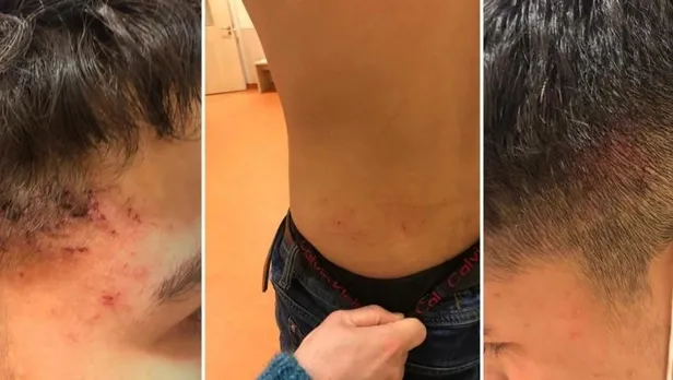 Almanya’da Türk çocuğu Emirhan Altınbaş'a polis şiddeti!-3