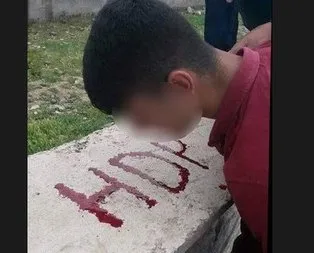 Dövdükleri çocuğun kanıyla HDP yazdılar!