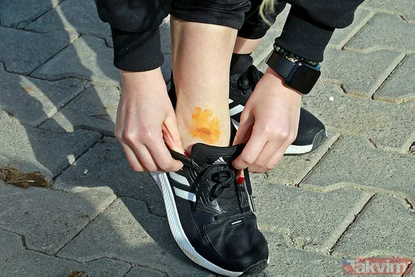 Asiye Ateş'ten sonra bir pitbull dehşeti daha! Dehşet anları anbean kamerada! - 7