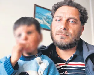 Varil bombasının acı yüzü