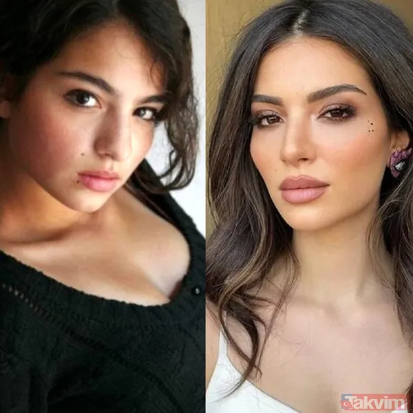 Yeşilçam’ın Sultan’ı Türkan Şoray'ın kızı Yağmur Ünal’ın son haline bakın! Botokstan konuşamadı! Gören şaştı kaldı - 13