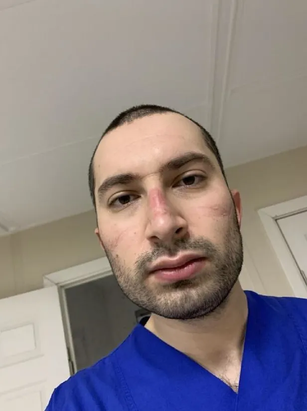 Koronavirüse yakalanan genç doktor 10 günde 8 kilo verdi! Tomografi görüntüsüyle uyardı!-2