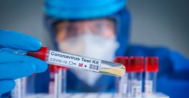 Covid-19 test sonucu ne zaman çıkar? PCR test sonucu kaç günde çıkar? E-Nabız koronavirüs test sonucu sorgulama ekranı!