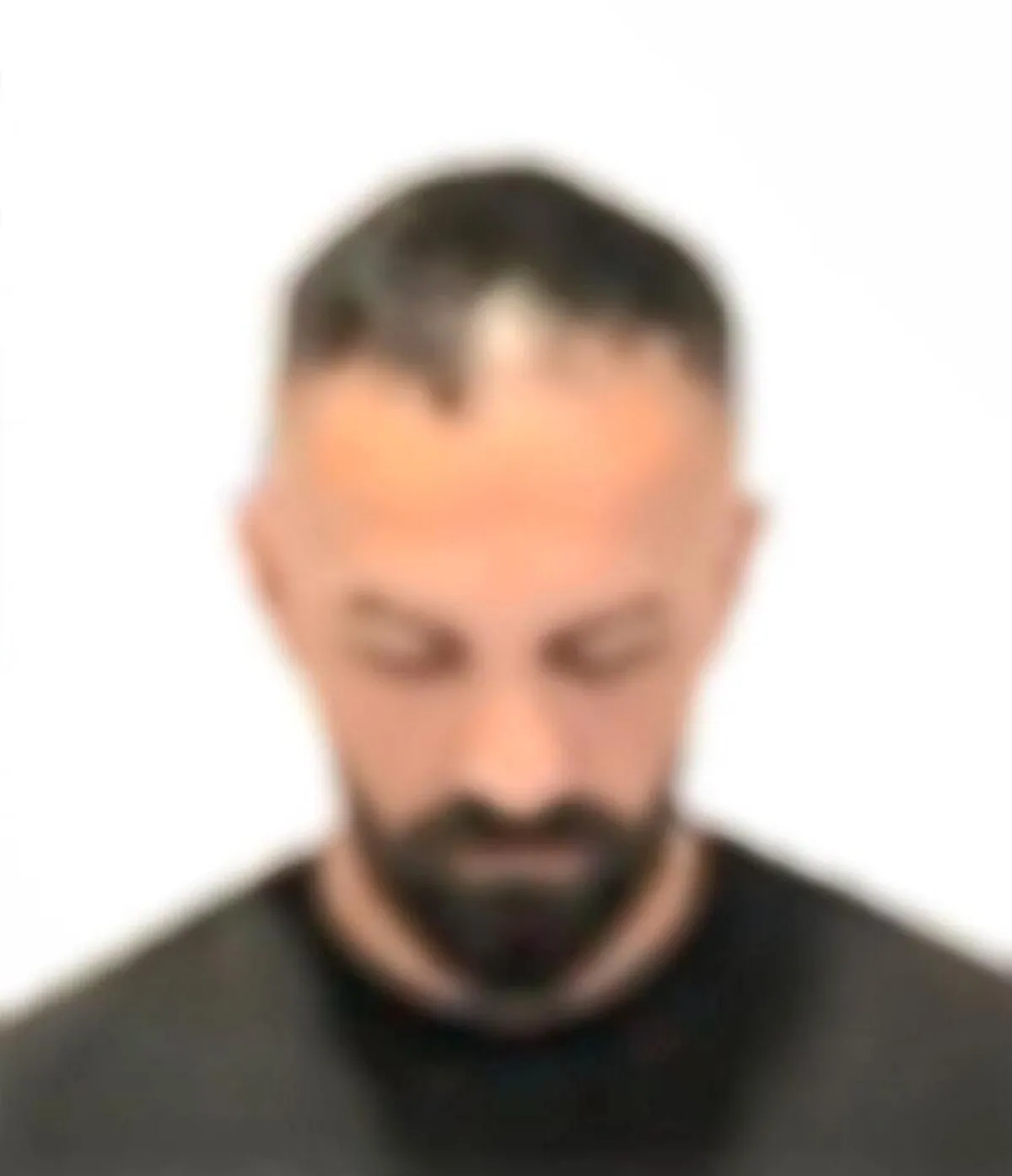 bakirkoydeki-epilasyon-merkezinde-skandal-kadinlarin-goruntulerini-para-karsiligi-sattilar-ifadeleri-takvimde-1788074885549.jpeg Bakırköy'deki epilasyon merkezinde skandal! Kadınların görüntülerini para karşılığı sattılar: İfadeleri Takvim'de-4