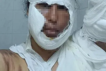 Gelin görümce kavgası kötü bitti