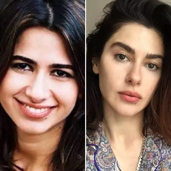 Yüz lifting yaptıran Ebru Yaşar’ın son hali olay oldu: İnsan bunu kendine nasıl yapar? - 17