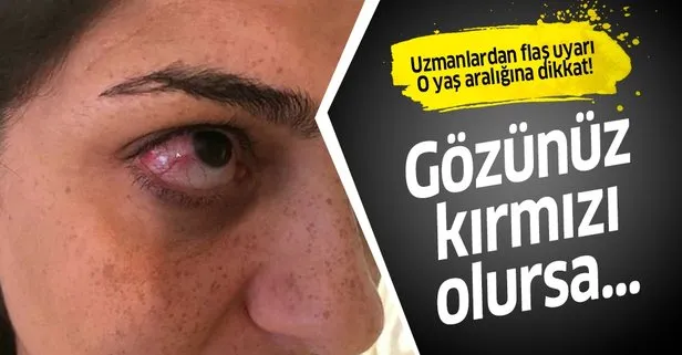 Tatilcilere Kirmizi Goz Hastaligi Uyarisi Takvim
