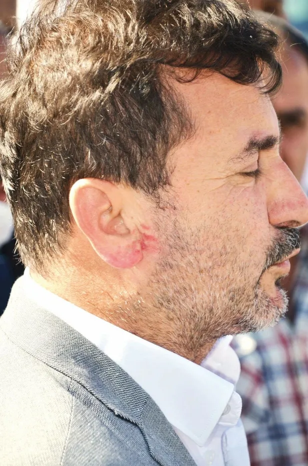 İYİ Parti Genel Merkezi'ndeki dayak skandalının mağdurları konuştu: Torunum yaşındaki çocuklardan sopa yedim-1