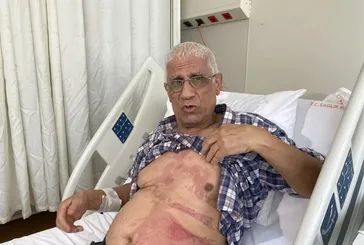 ’Açı’ ama gerçek