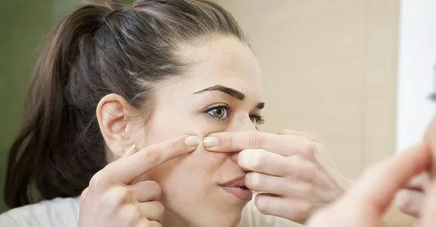 ruyada sivilce ciktigini gormek ne anlama gelir takvim