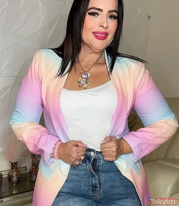 Midesi Kalbinin Arkasına Sıkıştı: Zayıflama Ameliyatı Hayatını Cehenneme Çevirdi - 4