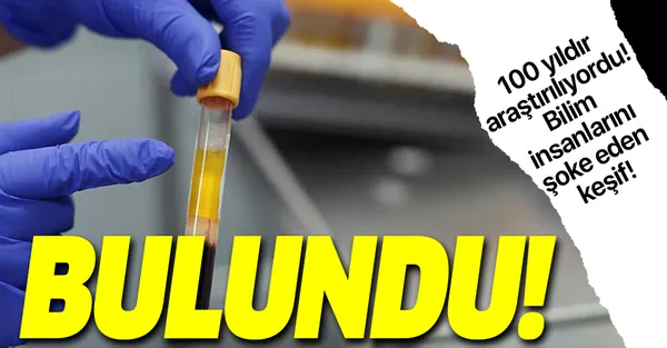 Bilim insanlarından dünyayı şoke eden açıklama! 100 yıldır araştırılan virüs...-1