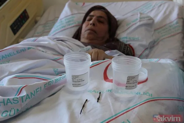 2 yaşındayken yuttu, 66 yıl sonra fark edildi