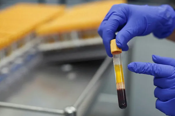 Bilim Kurulu Üyesi Prof. Dr. Ateş Kara koronavirüs aşısı için tarih verdi!-4