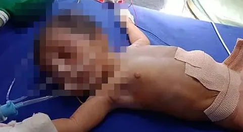 Bilim insanları dahi şaşkın! Yenidoğan bebeğin karnındaki şişliğin içinden çıkanlar kan dondurdu! Tümor sandılar ama tam 8 tane...-6