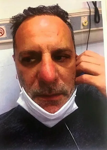 Ozan Güven’in darp ettiği Deniz Bulutsuz’un kamera görüntüleri ortaya çıktı! Çıplak ayakla sokağa kaçmış...-6