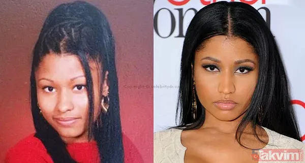 Bella Hadid ve Şeyma Subaşı'nın idolü Hailey Baldwin'in estetik açıklaması olay: Yüzüme asla dokunmadım! - 26