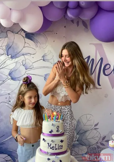 Acun Ilıcalı'nın yüzü gözü morluk içinde gören darp edildi sanıyor ama işin aslı başka! Estetik mi derken... - 21