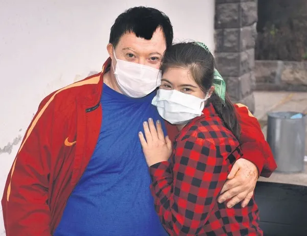 Down sendromlu Ece Güngör ile Serdal Rodoplu’nun aşkı, Covid’i aştı!-1