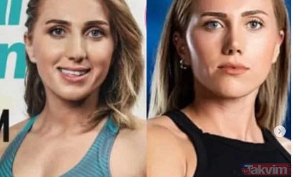 Masterchef Zeynep'e yaradı bıçak altına yattı bambaşka biri oldu! MasterChef Zeynep Alikoç estetikle öyle bir değişti ki... - 36