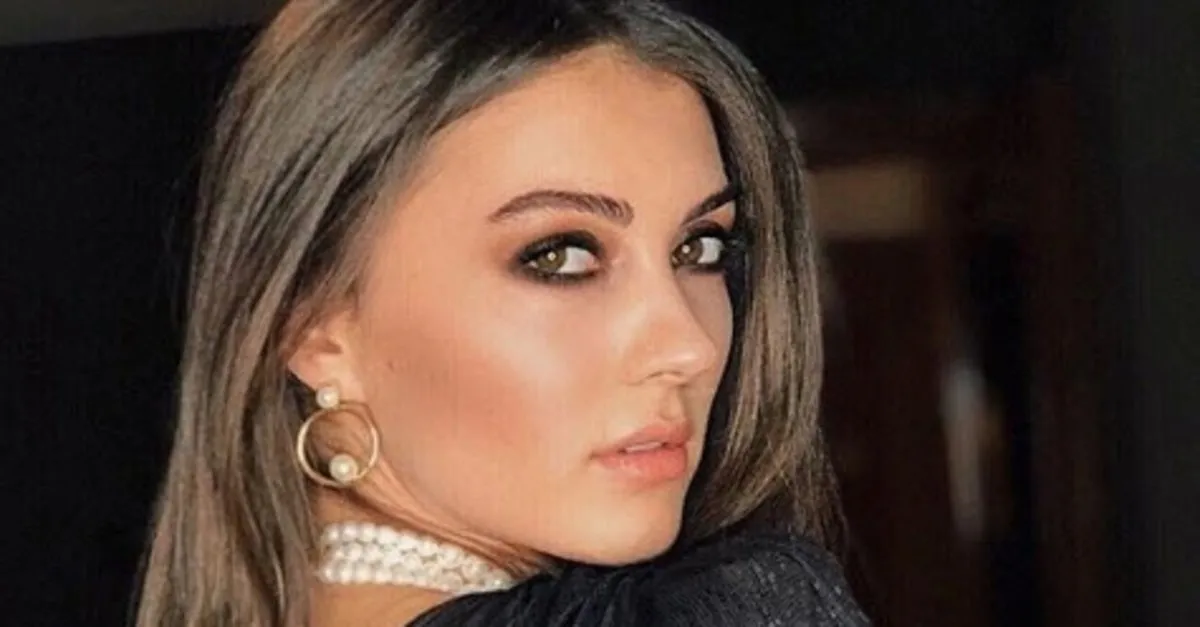 afili ask in ayse si burcu ozberk de estetik harikasi cikti estetiksiz halinden eser yok galeri takvim