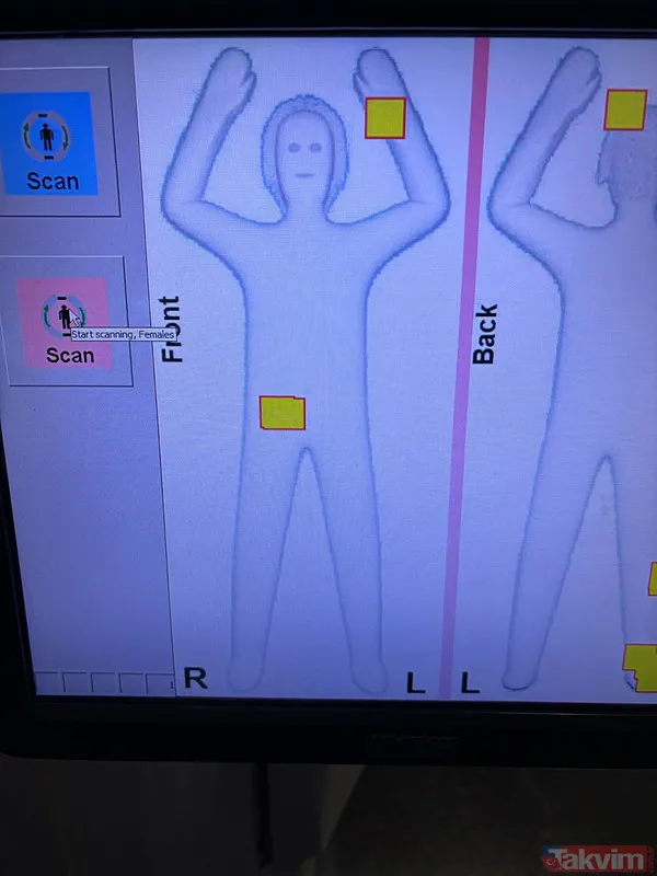 Cinsel organlarına saklamışlar... 3 kadın durduruldu: Tam 6 kilo altın çıktı! - 3