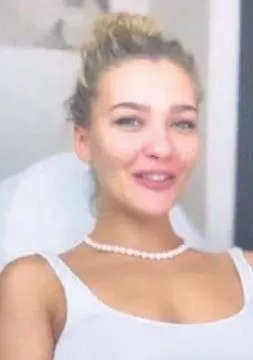 estetik-pismanligi-melisa-dongel-yuzundeki-yanlis-estetik-kurtulmak-icin-dolgularini-eritti-1694208614636.jpeg Estetik pişmanlığı! Melisa Döngel, yüzündeki yanlış estetiklerden kurtulmak için dolgularını eritti-5