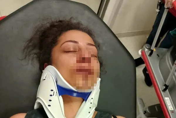 Komşuların kanlı pitbull kavgası