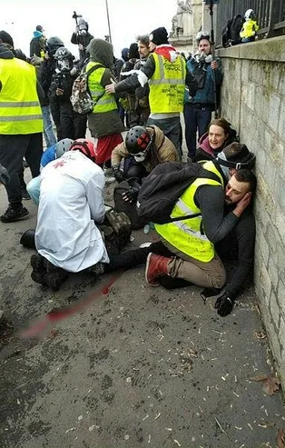 Paris'teki gösterilerde bir göstericinin kolu koptu!